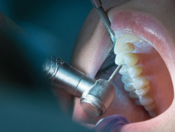 Endodoncia