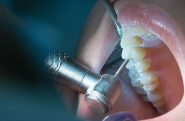 Endodoncia