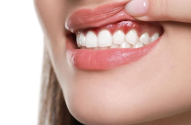 Periodoncia